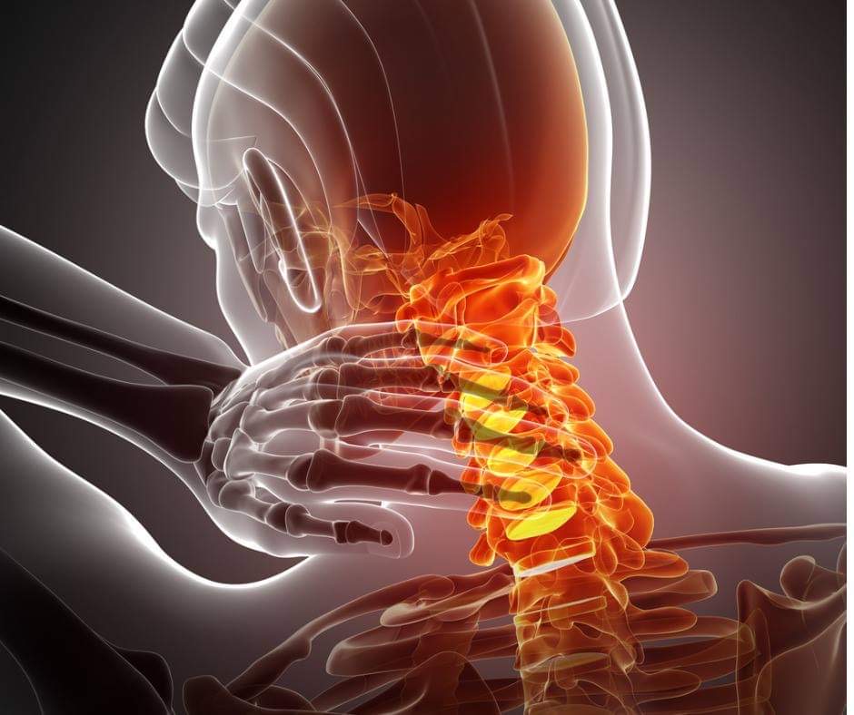 Neck Pain | Scottsdale, AZ Orthopedic Spine Surgery