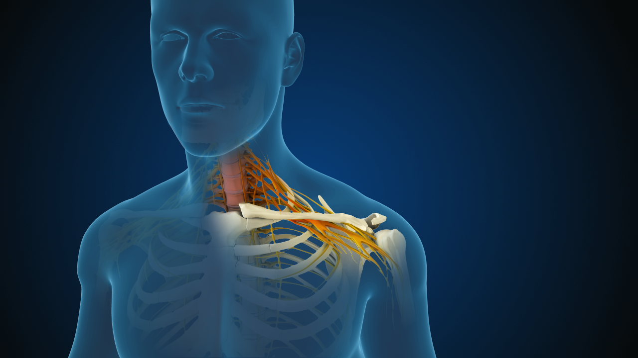 Cervical-Radiculopathy – Copy