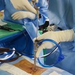Endoscopic surgery _during surgery