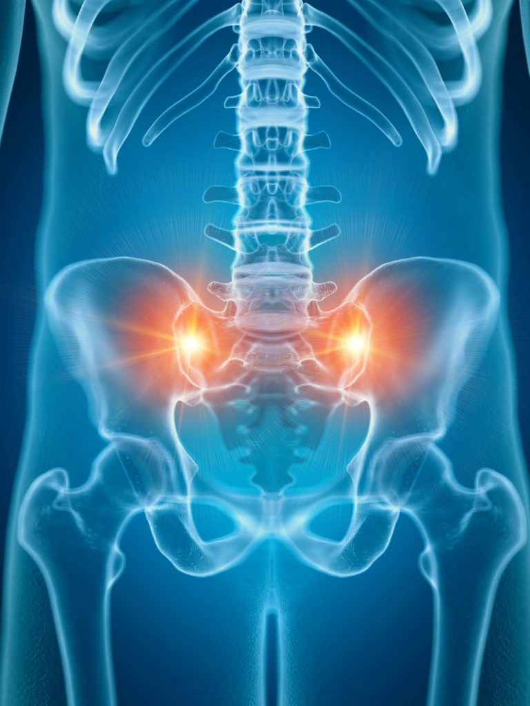 Sacroiliac Joint Pain/Dysfunction | Scottsdale, AZ Orthopedic Spine Surgery