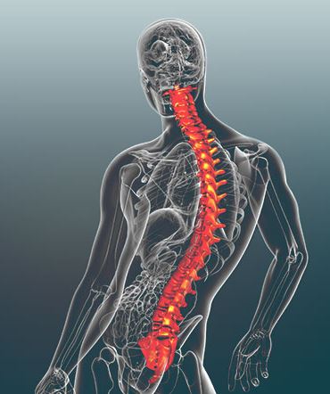 Scoliosis | Scottsdale, AZ Orthopedic Spine Surgery