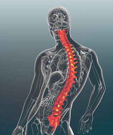 Scoliosis treatment to correct deviations of the spine