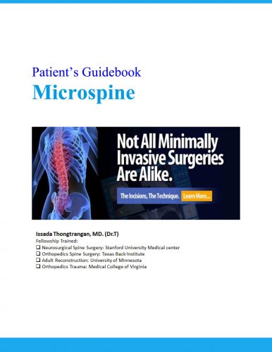 https://www.microspinemd.com/wp-content/uploads/elementor/thumbs/Microspine-e-book-1-ofsxb71a05s1zdh16cekmk26o6qlpkbridu19yzitc.jpg